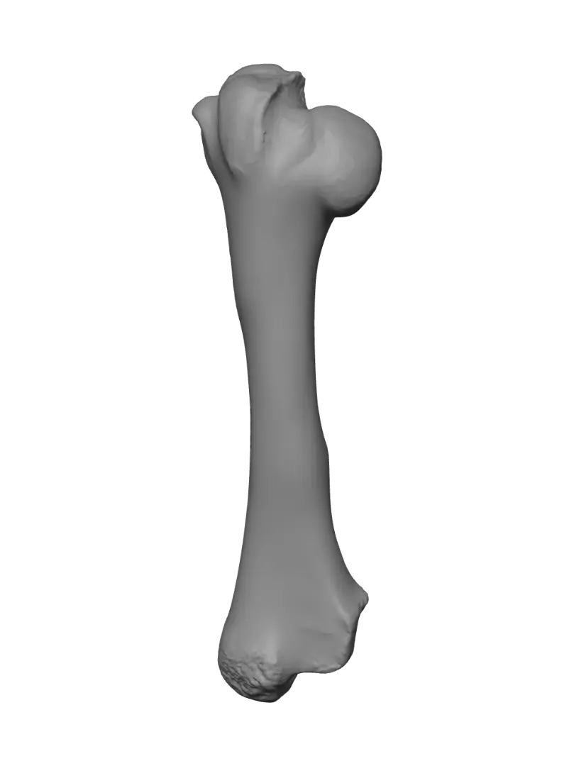 xray