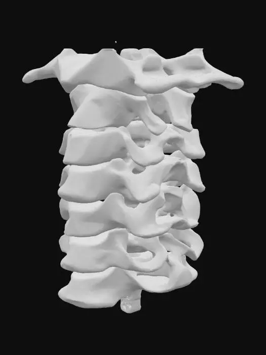 3D model for Cervical Spine Structure