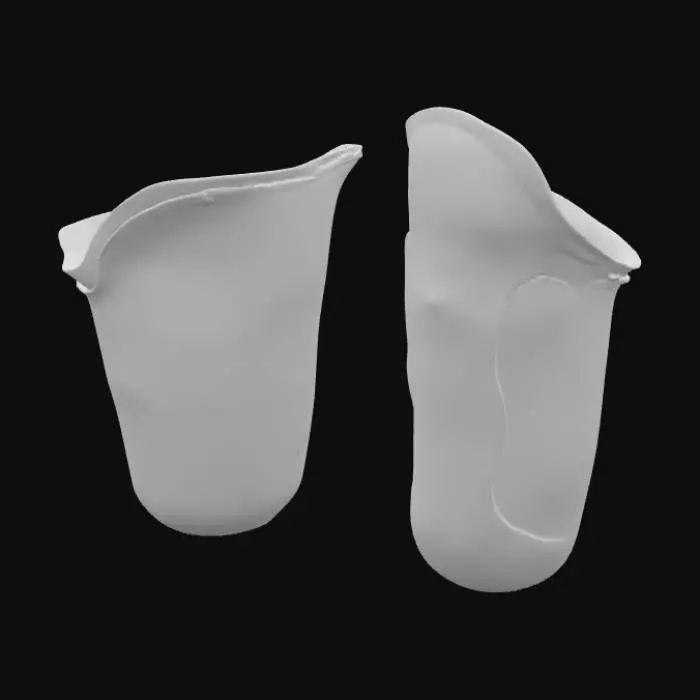 3D model for Prosthetic Socket Design