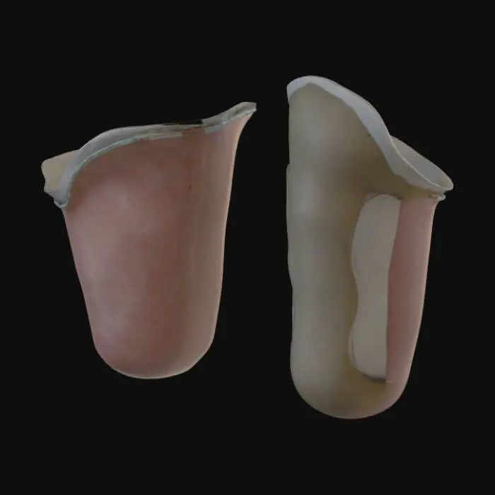 3D model for Prosthetic Socket Design