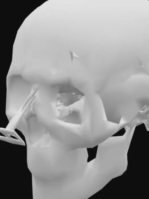 3D model for Lobotomy Procedure Diagram