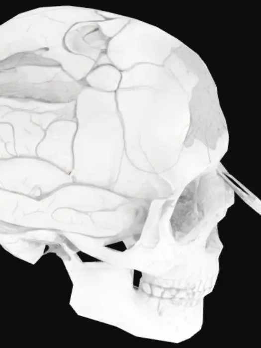 3D model for Lobotomy Procedure Diagram