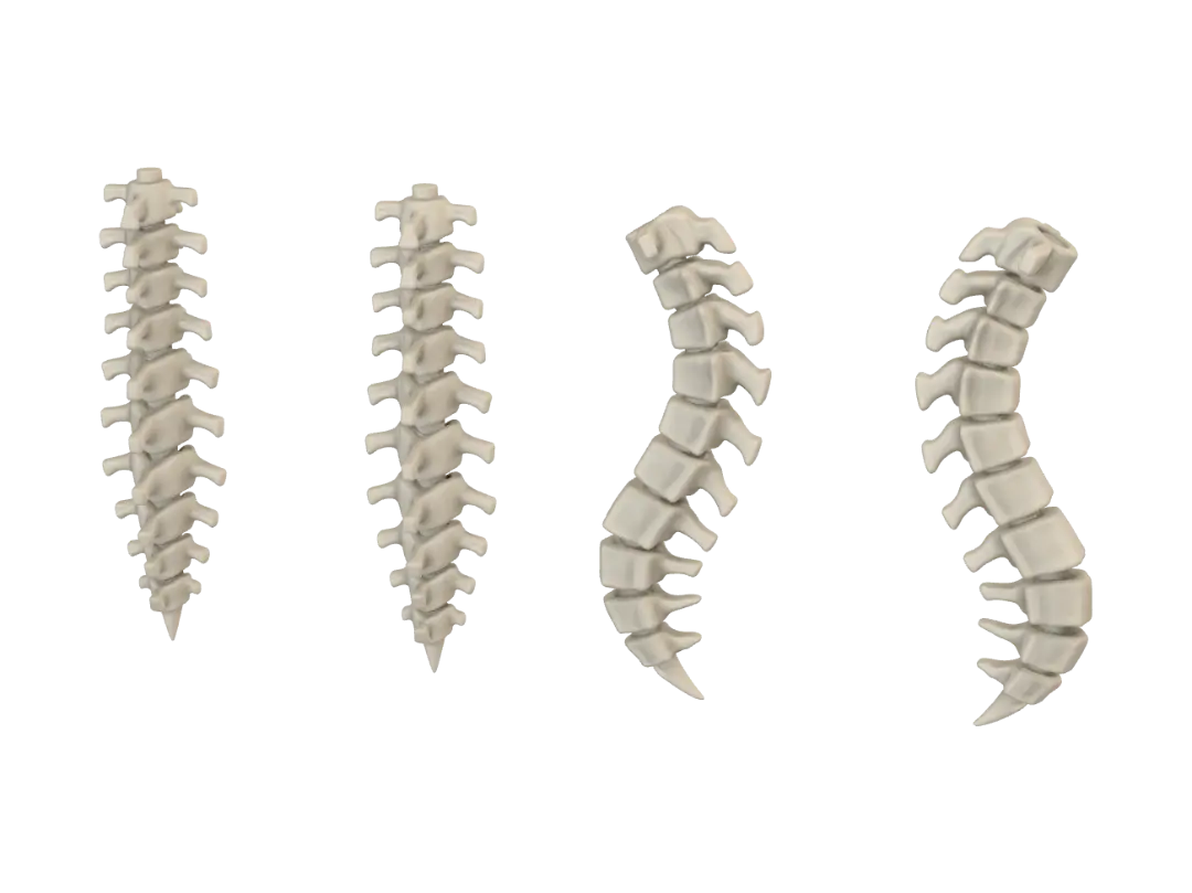 Espina Dorsal - Vertebrae 3D model, vytvořený pomocí AI