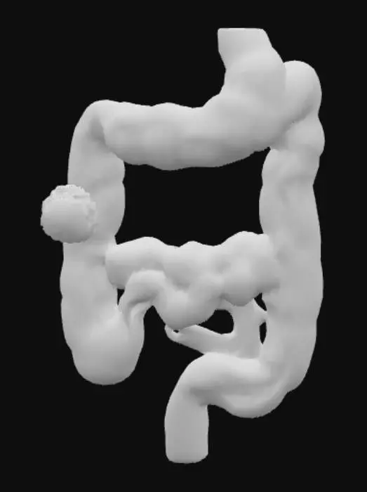 3D model for Show a small, spherical Dulcolax pill dissolving in the stomach, then tracking down through the small intestine and into the large intestine. Upon reaching the large intestine, a vibrant, pulsating energy wave emanates from the medication, spreading across the inner lining of the colon. This energy wave stimulates the nerve endings, causing the large intestine's muscular walls to contract rhythmically and more frequently, depicted as visible squeezing motions (peristalsis) that propagate along the length of the colon, pushing contents forward. Simultaneously, a subtle glowing effect appears within the lumen, representing increased fluid secretion into the bowel, which softens the stool. The overall effect should be an animated sequence.