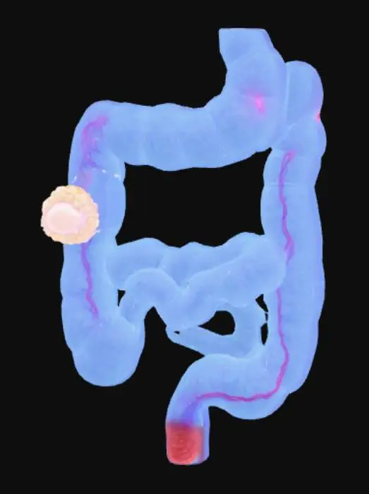 3D model for Show a small, spherical Dulcolax pill dissolving in the stomach, then tracking down through the small intestine and into the large intestine. Upon reaching the large intestine, a vibrant, pulsating energy wave emanates from the medication, spreading across the inner lining of the colon. This energy wave stimulates the nerve endings, causing the large intestine's muscular walls to contract rhythmically and more frequently, depicted as visible squeezing motions (peristalsis) that propagate along the length of the colon, pushing contents forward. Simultaneously, a subtle glowing effect appears within the lumen, representing increased fluid secretion into the bowel, which softens the stool. The overall effect should be an animated sequence.