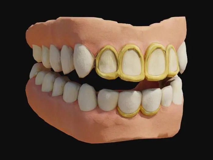 3D model for Gold and Silver Teeth Grills Diagram