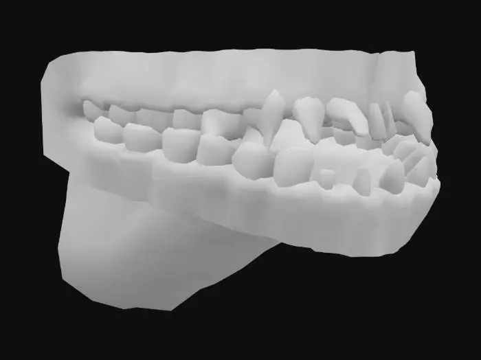 3D model for zombie-teeth