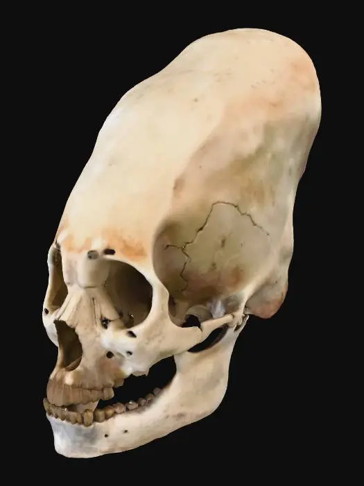 3D model for Elongated Skull Study