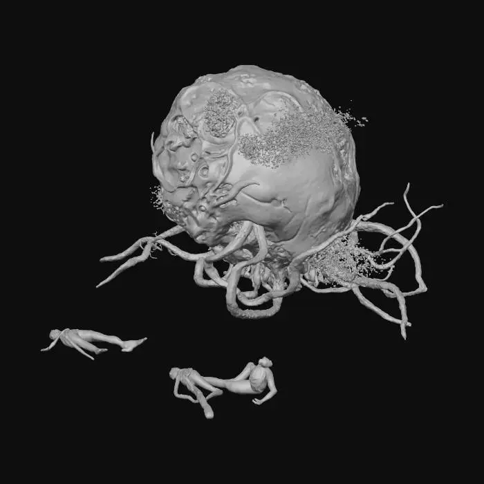 3D model for Pathogenic threat