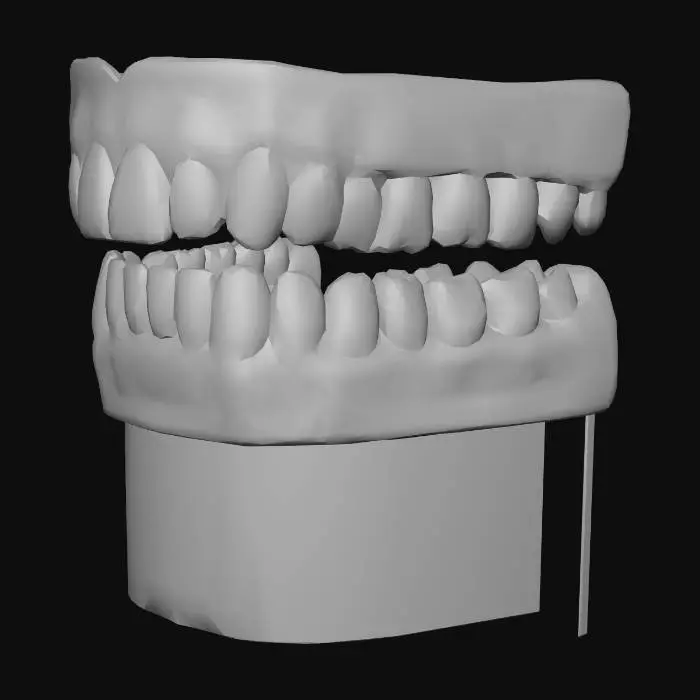 3D model for Dentures Display