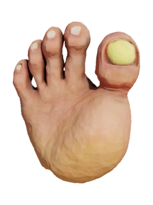 3D-модель A toe a huge toe ugly toenail, сгенерированная ИИ