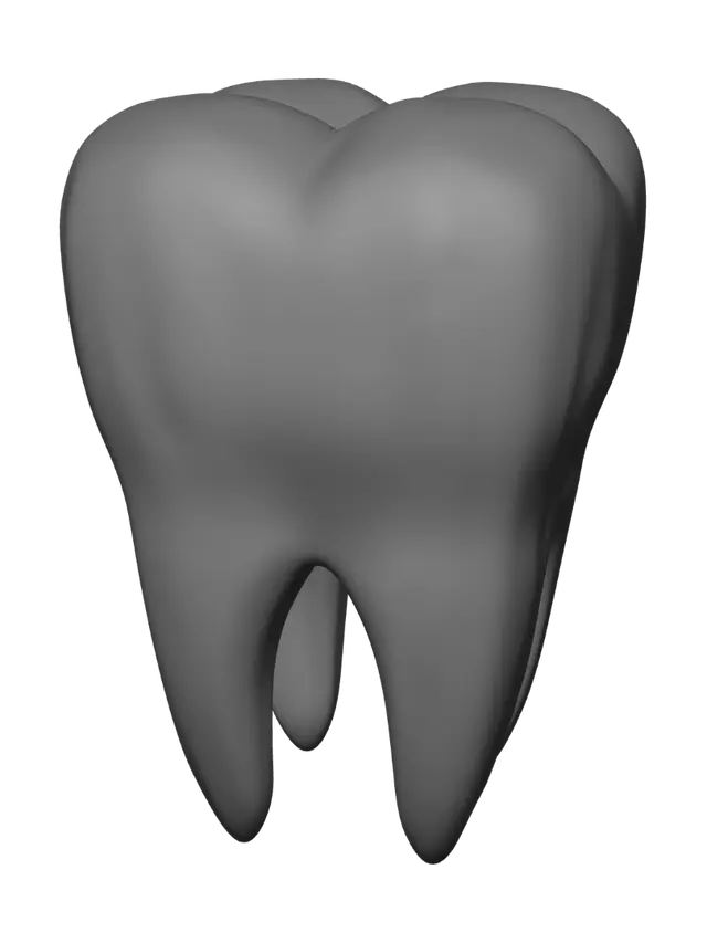 3D model for Radiant Molar