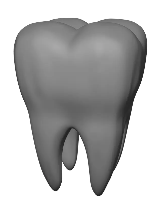 3D model for Radiant Molar