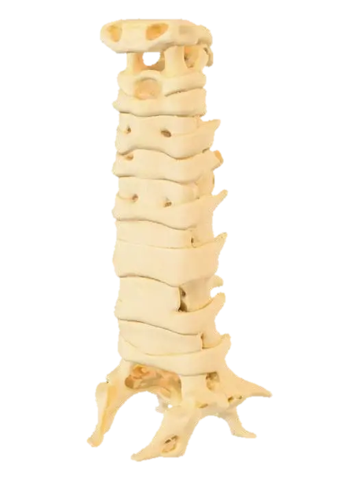 A Cervical Spine Bone Segment. - Vertebrae 3D model, vytvořený pomocí AI