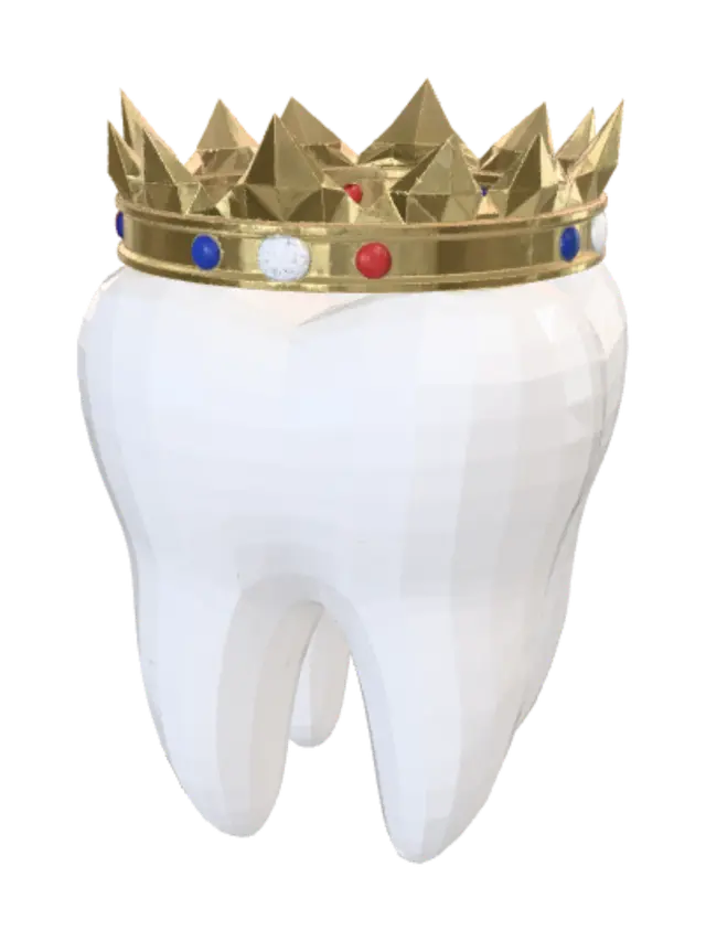 3D model for Crowned Tooth