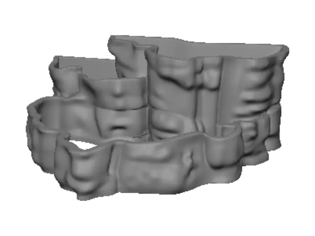 3D model for Tooth Cast