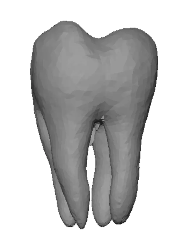 3D model for Molar Tooth