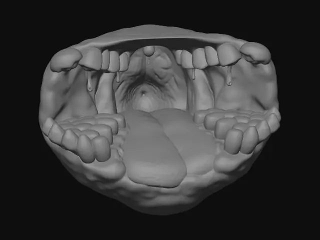 3D model for Oropharyngeal View