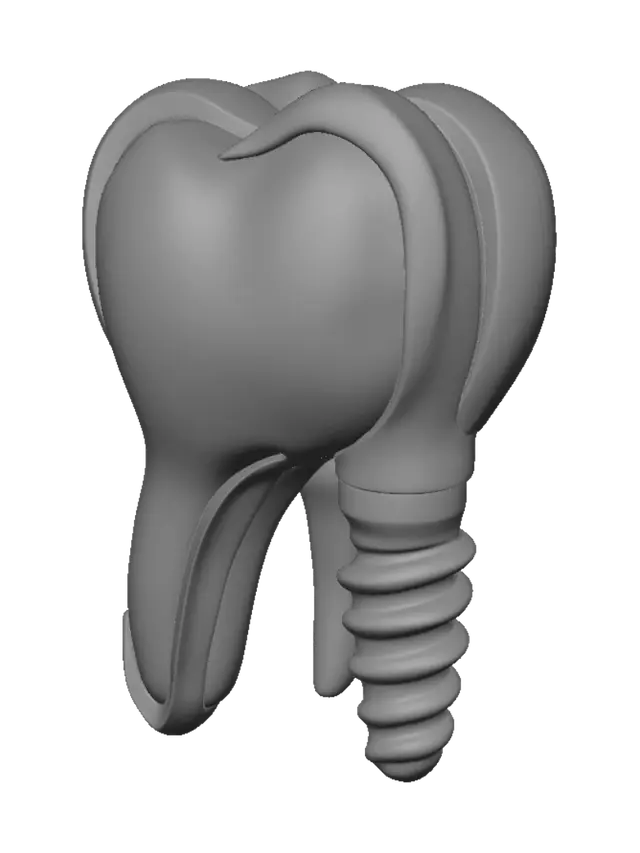 3D model for Dental Implant