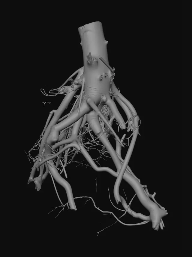3D model for Entangled Roots