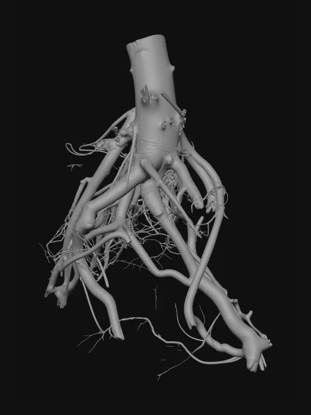 3D model for Entangled Roots