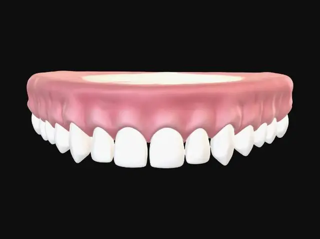 Free Denture 3D Models - Download Instantly | Meshy