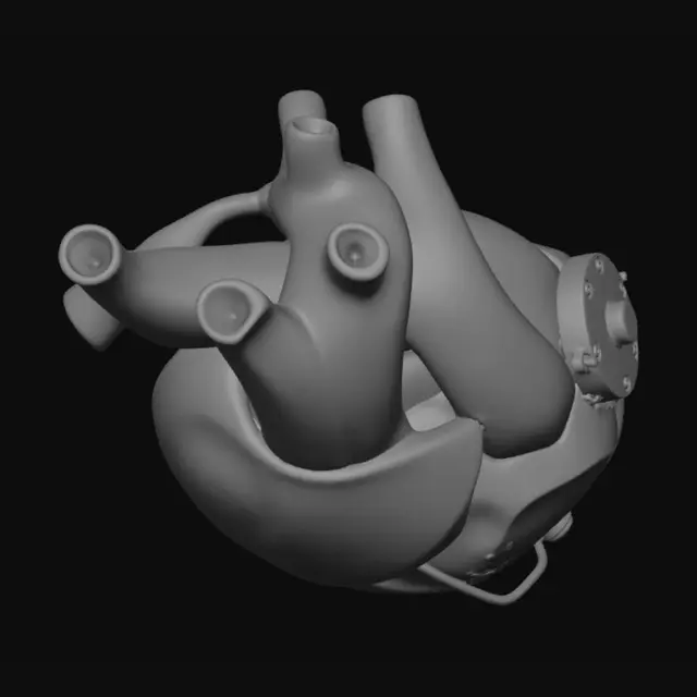 3D model for Craters human heart that shows the pace maker your born with and they create a pacemaker that you can attach to the heart once the bpm is below 60