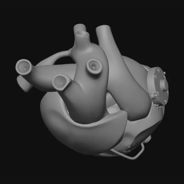 3D model for Craters human heart that shows the pace maker your born with and they create a pacemaker that you can attach to the heart once the bpm is below 60