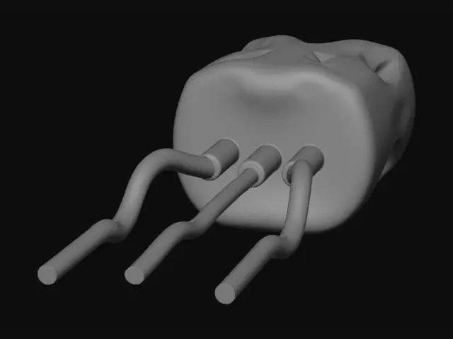 3D model for Quad-Lead Component